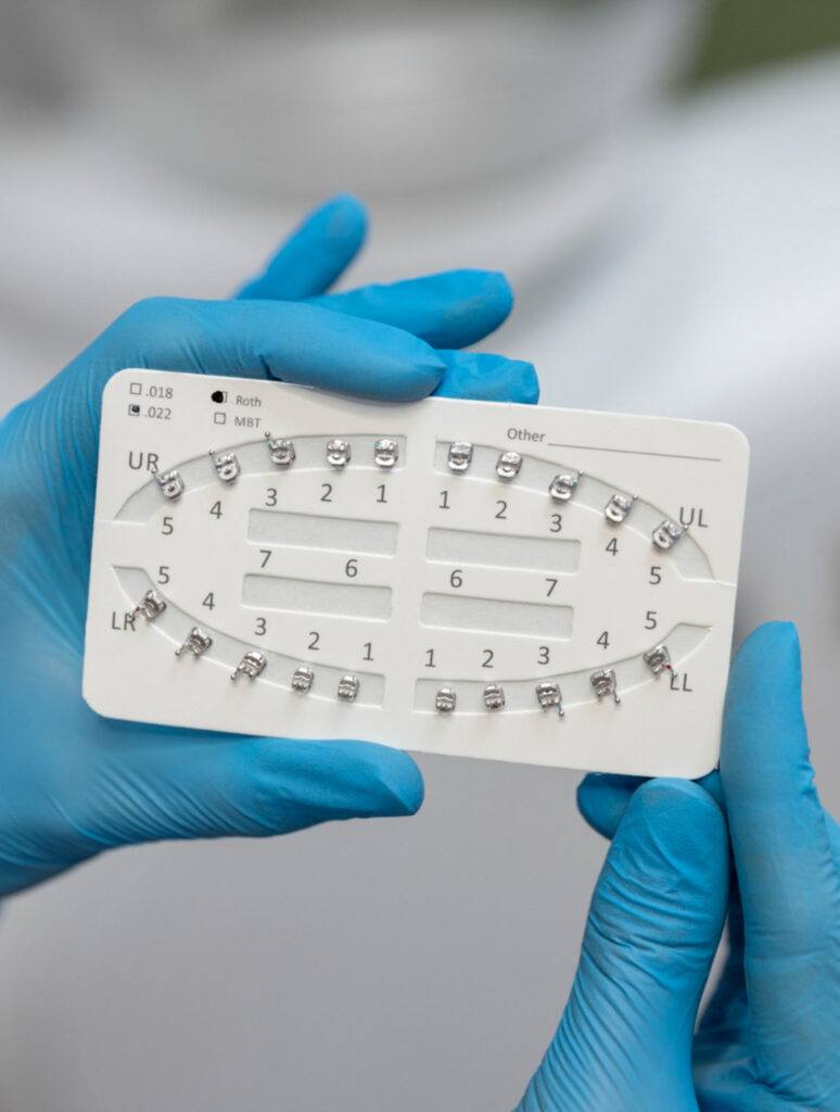Orthodontic brackets - Seoul Top Dental Hospital